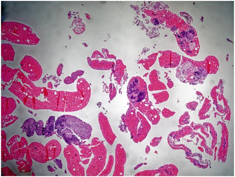 https://cdn.ncbi.nlm.nih.gov/pmc/blobs/0b49/8532252/26183811e89e/10.1177_17588359211047349-fig1.jpg