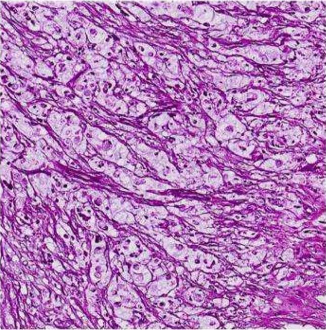 https://cdn.ncbi.nlm.nih.gov/pmc/blobs/0b4a/12000104/d82f5ada0693/383_2025_6020_Fig5_HTML.jpg