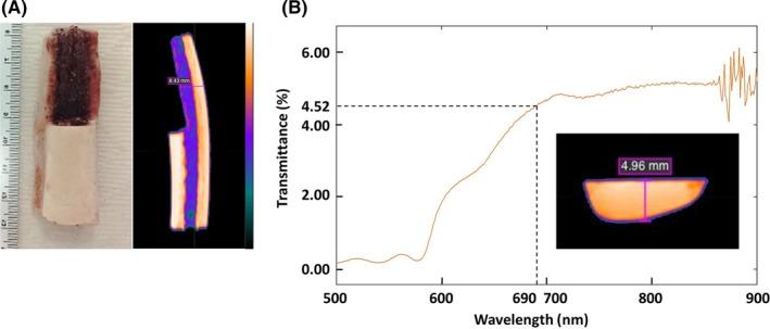 https://cdn.ncbi.nlm.nih.gov/pmc/blobs/0b4c/6890452/d5c2671ea8c8/CAS-110-3689-g001.jpg