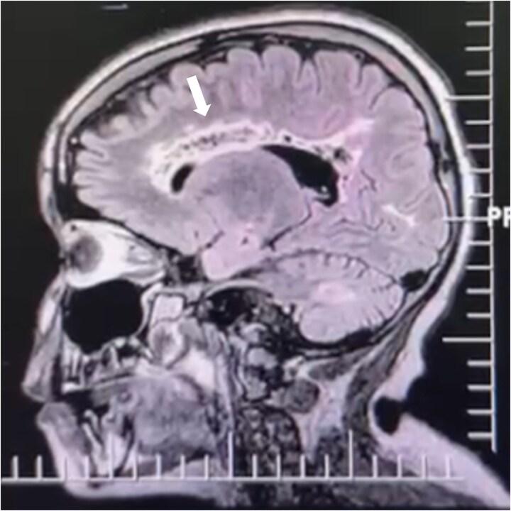 https://cdn.ncbi.nlm.nih.gov/pmc/blobs/0b52/12202306/b100d07b8d41/omaf061f1.jpg