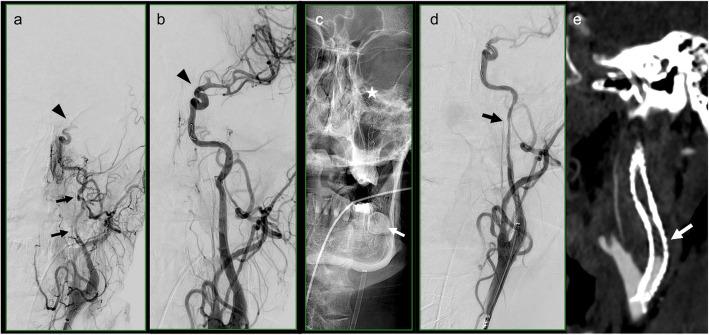 https://cdn.ncbi.nlm.nih.gov/pmc/blobs/0b58/12098224/724a282abdbf/42155_2025_564_Fig3_HTML.jpg