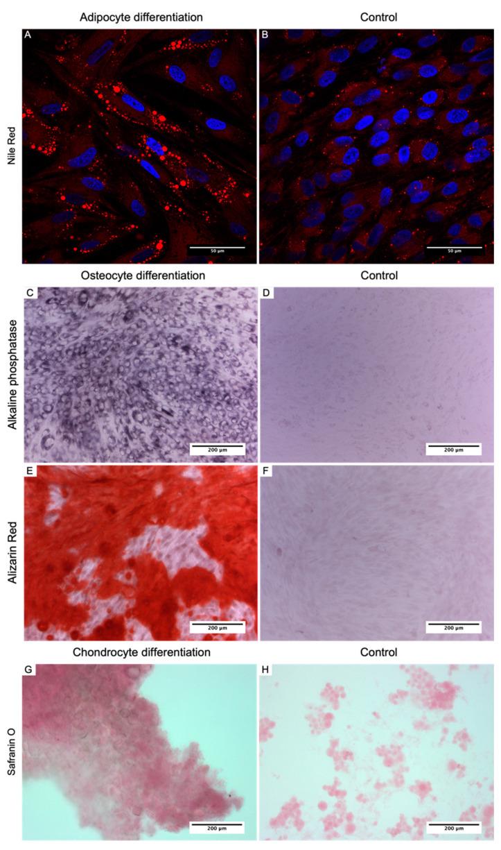 https://cdn.ncbi.nlm.nih.gov/pmc/blobs/0b58/8465718/9022b72c7c7c/biomedicines-09-01134-g004.jpg