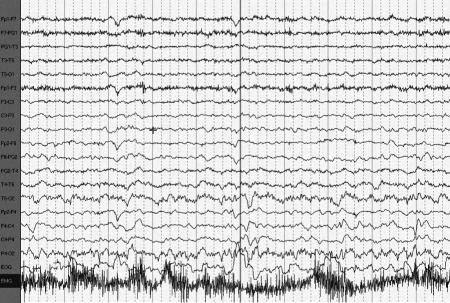 https://cdn.ncbi.nlm.nih.gov/pmc/blobs/0b5c/2854979/a70950af08ee/jcn-2-272-g003.jpg