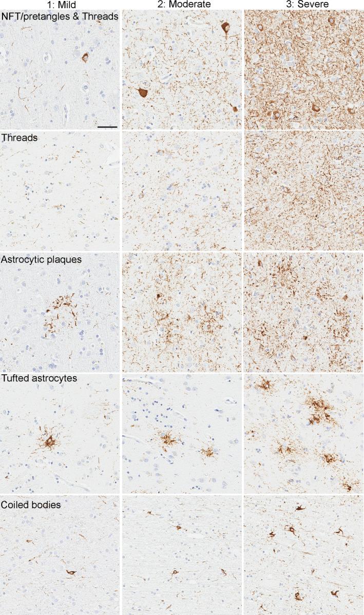https://cdn.ncbi.nlm.nih.gov/pmc/blobs/0b61/9292481/f6c3b5672c8a/NAN-47-931-g005.jpg