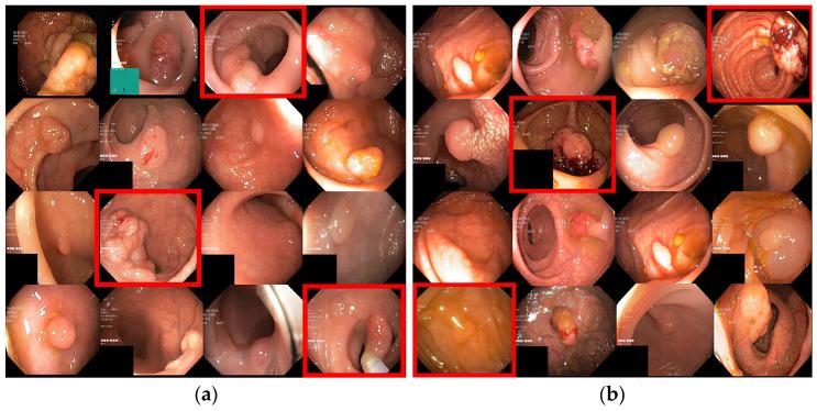 https://cdn.ncbi.nlm.nih.gov/pmc/blobs/0b67/10534485/0af3b555ef9e/sensors-23-07724-g010.jpg