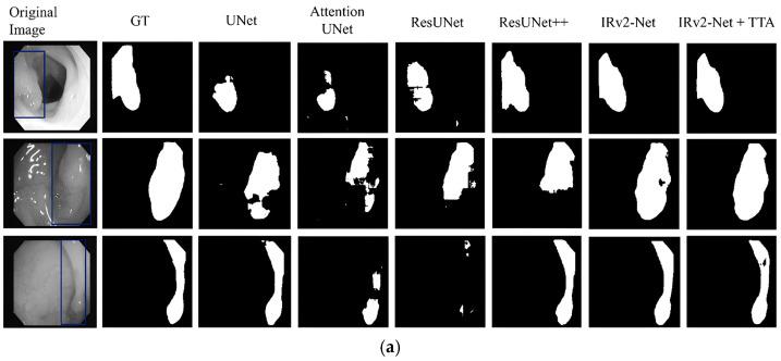 https://cdn.ncbi.nlm.nih.gov/pmc/blobs/0b67/10534485/2ba17115784c/sensors-23-07724-g013a.jpg