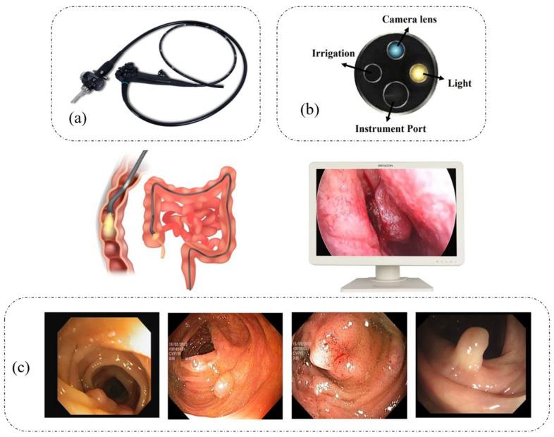https://cdn.ncbi.nlm.nih.gov/pmc/blobs/0b67/10534485/e67d3d96bf27/sensors-23-07724-g001.jpg