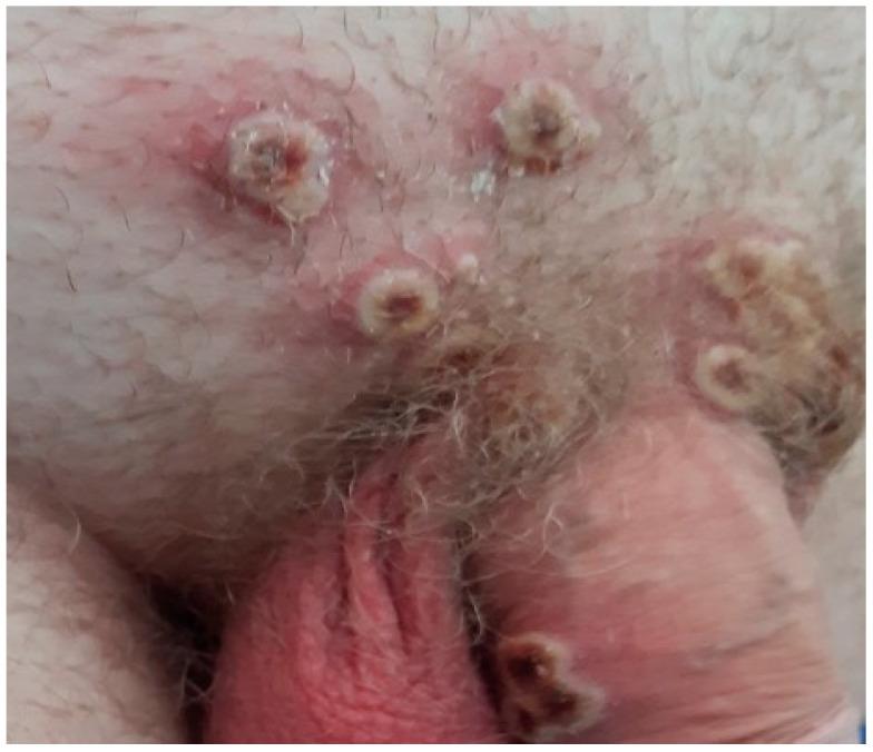 https://cdn.ncbi.nlm.nih.gov/pmc/blobs/0b6e/11855485/f8a200a8e008/idr-17-00009-g002.jpg