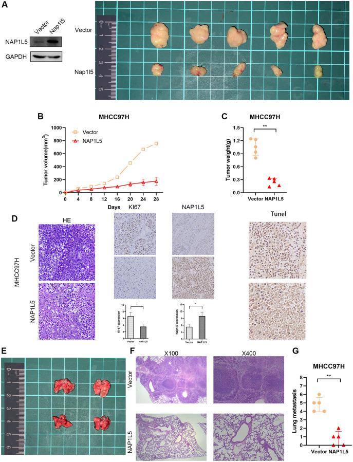 https://cdn.ncbi.nlm.nih.gov/pmc/blobs/0b6e/9740361/c4aa457a2081/aging-14-204377-g005.jpg