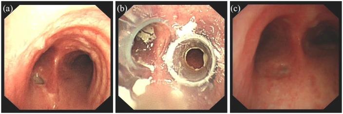 https://cdn.ncbi.nlm.nih.gov/pmc/blobs/0b70/6724482/13b0968f0d33/10.1177_1753466619871523-fig1.jpg
