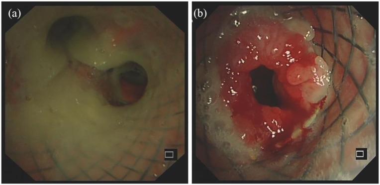 https://cdn.ncbi.nlm.nih.gov/pmc/blobs/0b70/6724482/8ae3e324ab9b/10.1177_1753466619871523-fig3.jpg