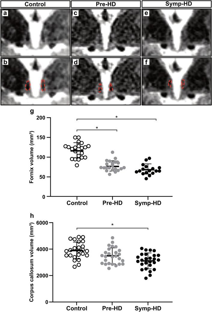 https://cdn.ncbi.nlm.nih.gov/pmc/blobs/0b71/8500909/576a7edf60ba/401_2021_2362_Fig1_HTML.jpg