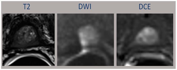 https://cdn.ncbi.nlm.nih.gov/pmc/blobs/0b71/9914595/a38668ee2f0a/diagnostics-13-00387-g003.jpg