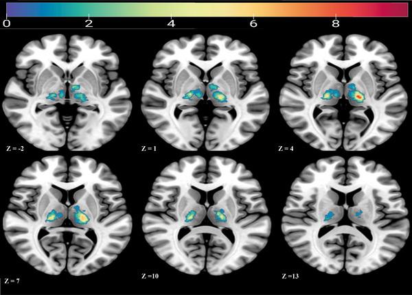 https://cdn.ncbi.nlm.nih.gov/pmc/blobs/0b73/12105651/0167b93ea714/BRB3-15-e70582-g001.jpg
