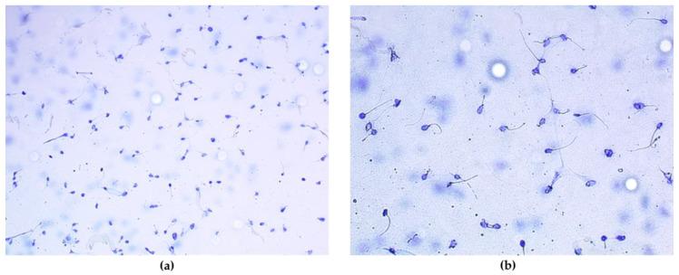 https://cdn.ncbi.nlm.nih.gov/pmc/blobs/0b76/11504984/b3ecd3ed09c3/antioxidants-13-01181-g001.jpg