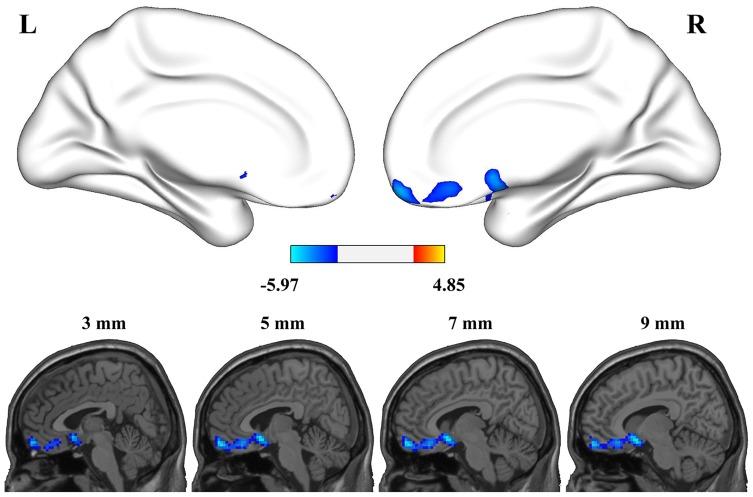 https://cdn.ncbi.nlm.nih.gov/pmc/blobs/0b7d/7093095/86ec56a9a694/JPR-13-575-g0002.jpg