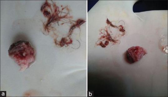 https://cdn.ncbi.nlm.nih.gov/pmc/blobs/0b7e/6703017/8929cad646e1/AJNS-14-975-g005.jpg