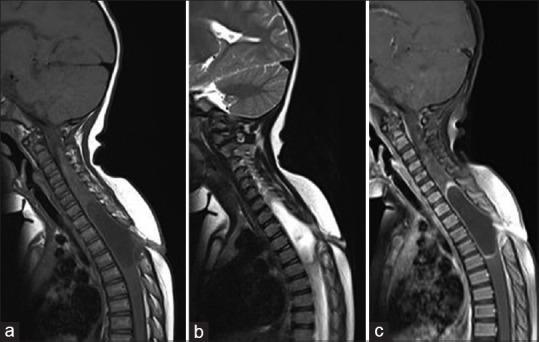 https://cdn.ncbi.nlm.nih.gov/pmc/blobs/0b7e/6703017/b5b30193725d/AJNS-14-975-g002.jpg