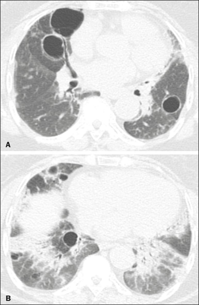https://cdn.ncbi.nlm.nih.gov/pmc/blobs/0b8d/7545736/11febcec234c/rb-53-05-0287-g03.jpg