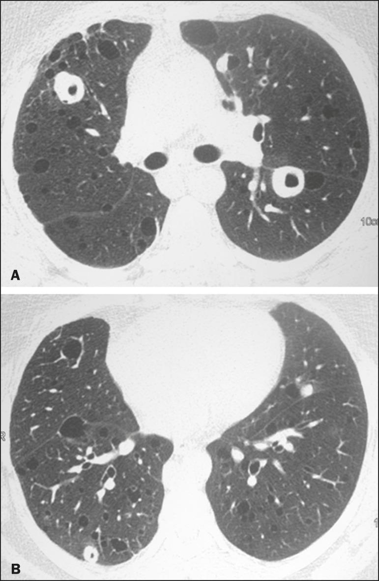 https://cdn.ncbi.nlm.nih.gov/pmc/blobs/0b8d/7545736/fba7e1aa8cfc/rb-53-05-0287-g04.jpg