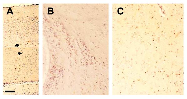 https://cdn.ncbi.nlm.nih.gov/pmc/blobs/0b90/2837049/105760fbdaa0/1471-2202-11-26-2.jpg