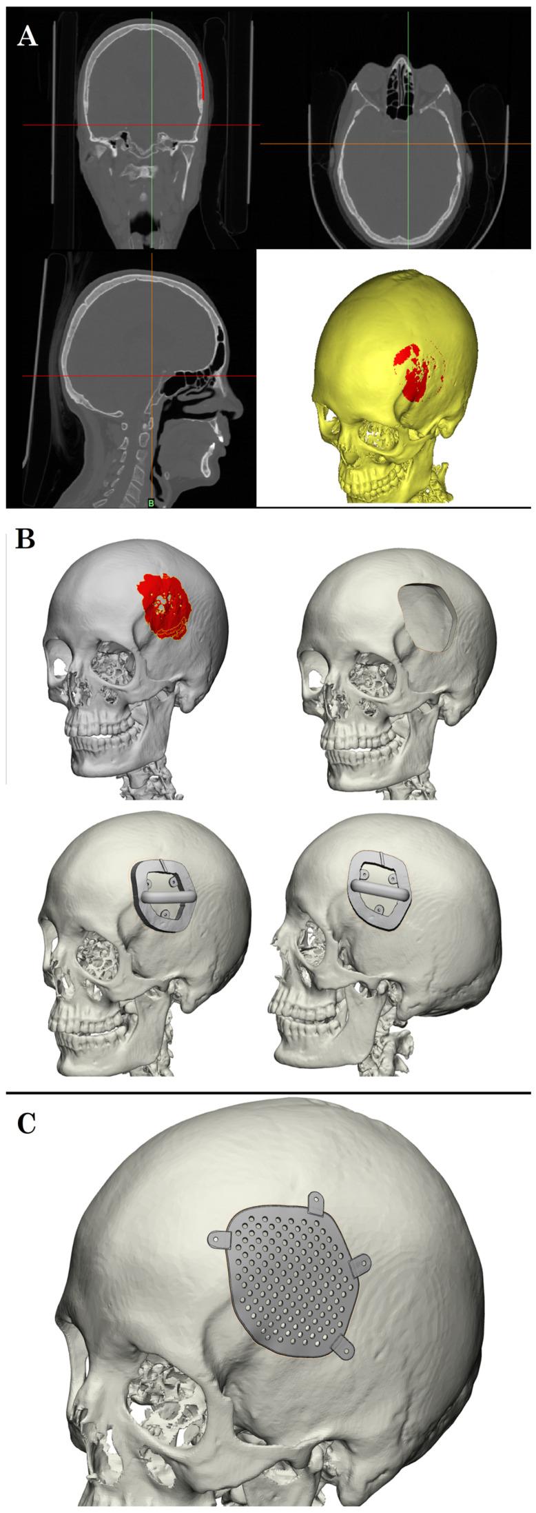 https://cdn.ncbi.nlm.nih.gov/pmc/blobs/0b93/12026340/123115c2d0ab/brainsci-15-00420-g002.jpg