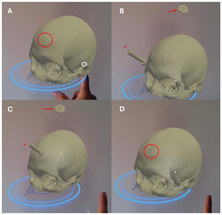 https://cdn.ncbi.nlm.nih.gov/pmc/blobs/0b93/12026340/a569173ce1f0/brainsci-15-00420-g003.jpg