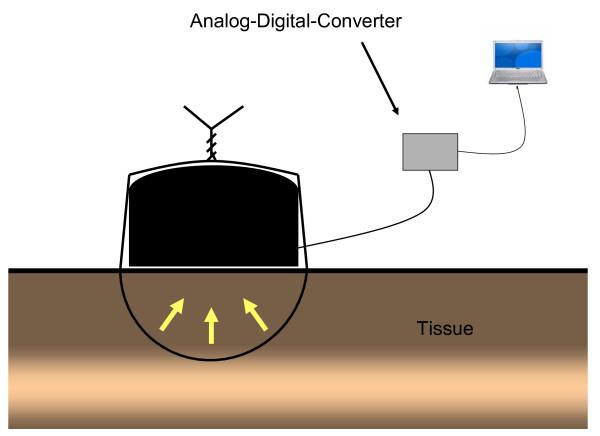 https://cdn.ncbi.nlm.nih.gov/pmc/blobs/0b9c/3275509/2ed4bee6afaf/1471-2482-11-36-2.jpg