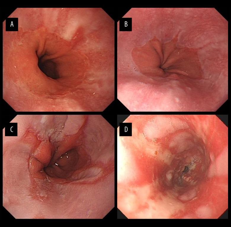 https://cdn.ncbi.nlm.nih.gov/pmc/blobs/0b9c/6069462/231f6d61206c/medscimonit-24-4791-g001.jpg