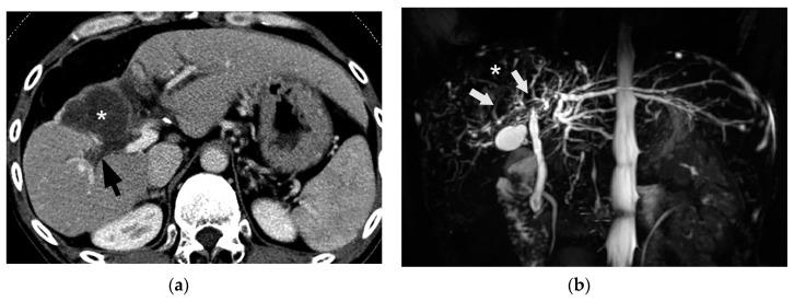 https://cdn.ncbi.nlm.nih.gov/pmc/blobs/0b9f/7565329/3a372b2f0f50/cancers-12-02596-g014.jpg