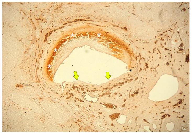 https://cdn.ncbi.nlm.nih.gov/pmc/blobs/0b9f/7565329/911390458187/cancers-12-02596-g006.jpg