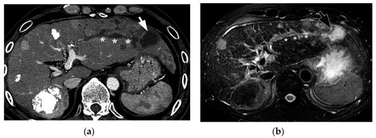 https://cdn.ncbi.nlm.nih.gov/pmc/blobs/0b9f/7565329/ae041086e34b/cancers-12-02596-g013.jpg