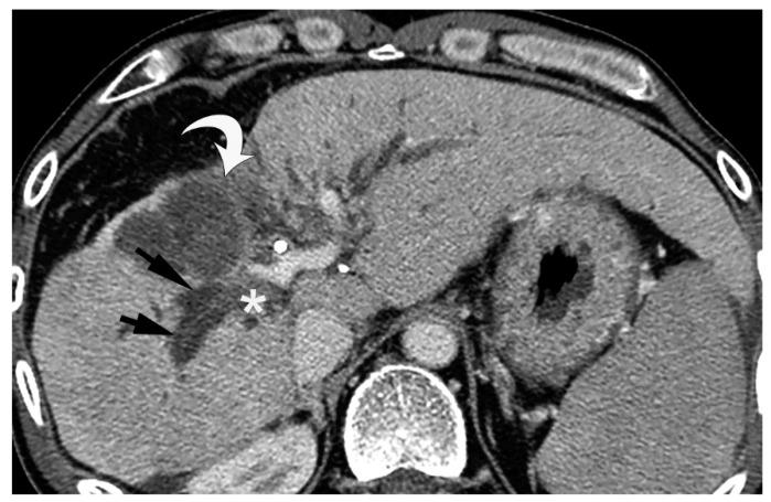 https://cdn.ncbi.nlm.nih.gov/pmc/blobs/0b9f/7565329/afc63e13ddba/cancers-12-02596-g010.jpg