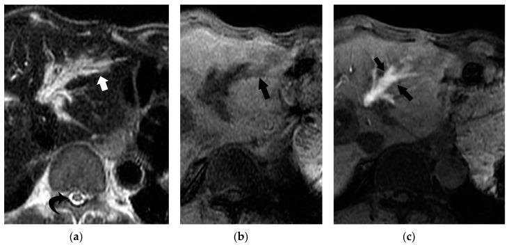 https://cdn.ncbi.nlm.nih.gov/pmc/blobs/0b9f/7565329/bb1c5cd4d296/cancers-12-02596-g015.jpg