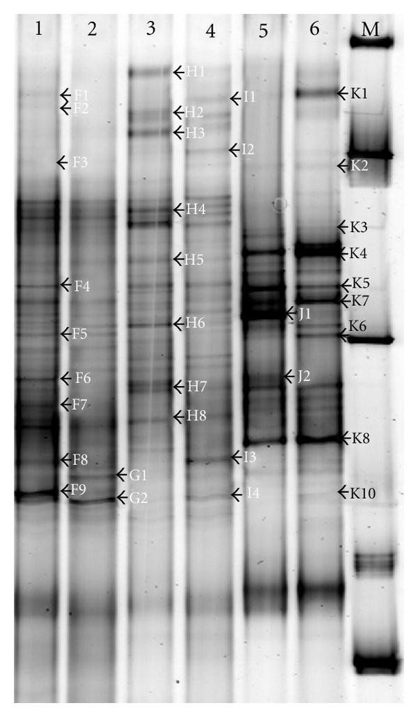 https://cdn.ncbi.nlm.nih.gov/pmc/blobs/0ba1/3172987/4f04562617f9/ECAM2011-487543.003.jpg