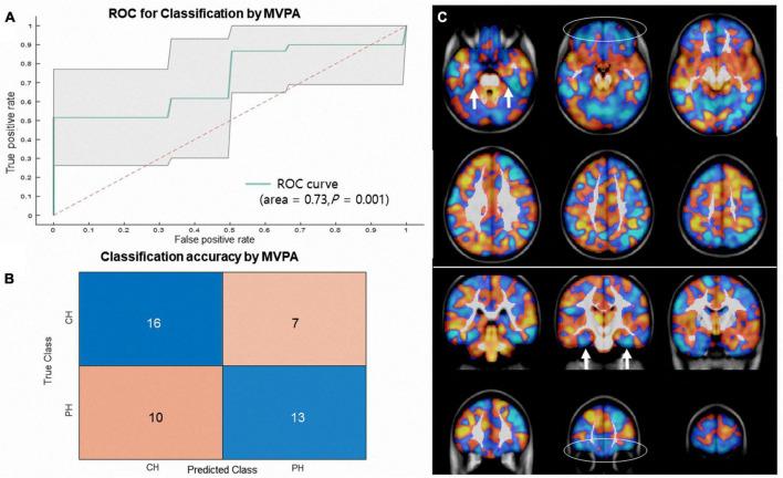 https://cdn.ncbi.nlm.nih.gov/pmc/blobs/0ba4/10267340/693b0d6a77a3/fnhum-17-1202103-g003.jpg