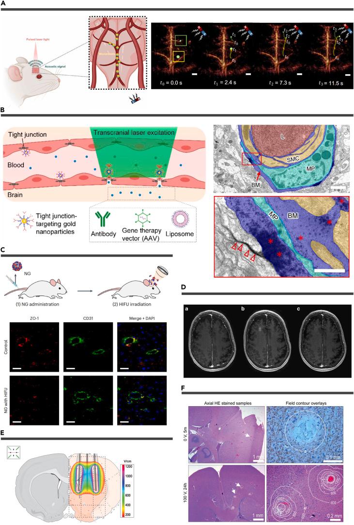 https://cdn.ncbi.nlm.nih.gov/pmc/blobs/0ba8/10757293/da9c6684b842/gr6.jpg