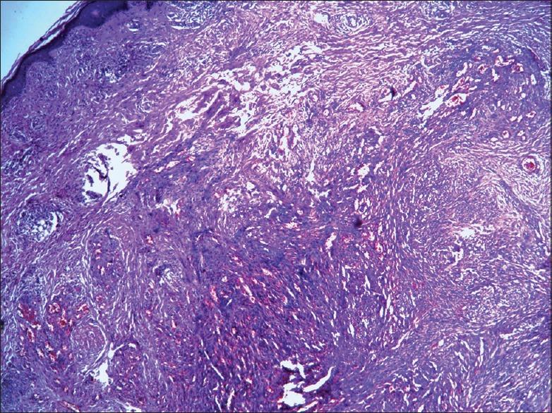 https://cdn.ncbi.nlm.nih.gov/pmc/blobs/0baa/4458972/30b4e773e402/IJD-60-323b-g003.jpg