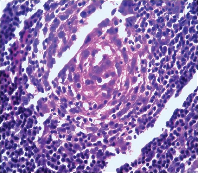 https://cdn.ncbi.nlm.nih.gov/pmc/blobs/0baa/4458972/4e98e4eee312/IJD-60-323b-g004.jpg