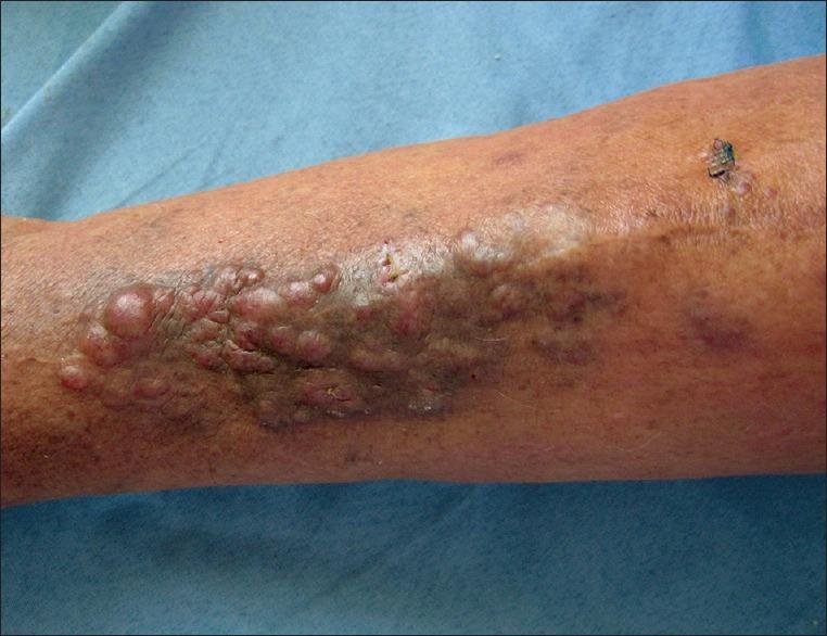 https://cdn.ncbi.nlm.nih.gov/pmc/blobs/0baa/4458972/c144505b7c99/IJD-60-323b-g001.jpg