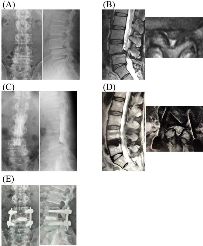 https://cdn.ncbi.nlm.nih.gov/pmc/blobs/0bad/10149142/b47381727cec/2188-4226-10-0087-g001.jpg