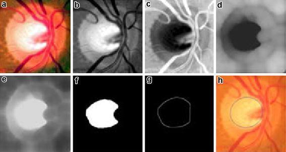 https://cdn.ncbi.nlm.nih.gov/pmc/blobs/0bb0/5017972/12334dd7d7b5/40064_2016_3175_Fig4_HTML.jpg