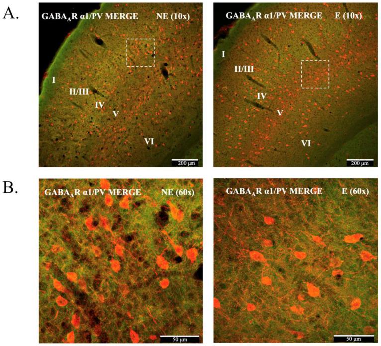 https://cdn.ncbi.nlm.nih.gov/pmc/blobs/0bb2/9778655/ff9444d50169/ijms-23-15685-g002.jpg