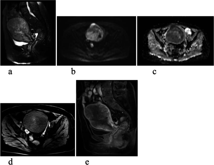 https://cdn.ncbi.nlm.nih.gov/pmc/blobs/0bb7/10877902/7512a1a538fe/12880_2024_1225_Fig2_HTML.jpg