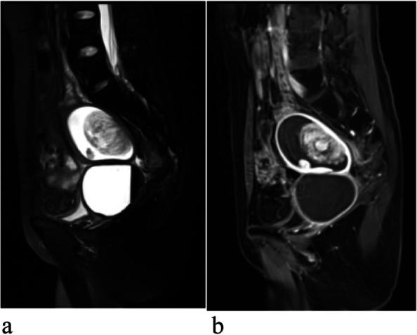 https://cdn.ncbi.nlm.nih.gov/pmc/blobs/0bb7/10877902/856b252bf383/12880_2024_1225_Fig3_HTML.jpg