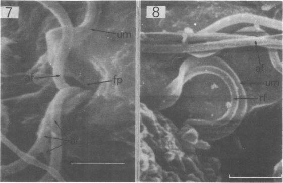 https://cdn.ncbi.nlm.nih.gov/pmc/blobs/0bbe/1045885/60b23e383acc/brjvendis00020-0029-a.jpg