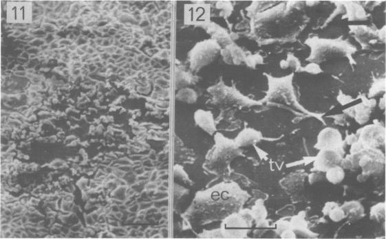 https://cdn.ncbi.nlm.nih.gov/pmc/blobs/0bbe/1045885/ba60752837e1/brjvendis00020-0031-a.jpg
