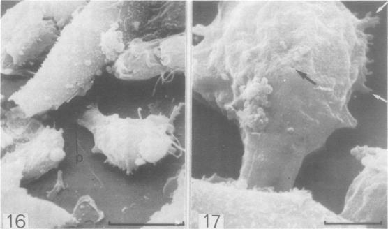 https://cdn.ncbi.nlm.nih.gov/pmc/blobs/0bbe/1045885/c4f9f29fcc56/brjvendis00020-0034-a.jpg
