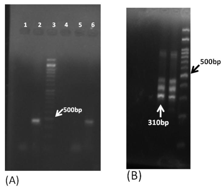 https://cdn.ncbi.nlm.nih.gov/pmc/blobs/0bbe/9783764/4a0eea541d86/pathogens-11-01509-g005.jpg