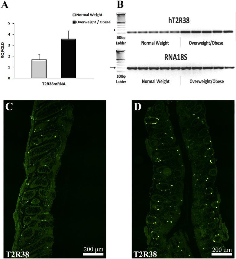 https://cdn.ncbi.nlm.nih.gov/pmc/blobs/0bc6/4750998/66ff3ddd3510/pone.0147468.g001.jpg